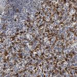 C1QC Antibody in Immunohistochemistry (IHC)