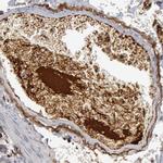 C1QC Antibody in Immunohistochemistry (IHC)