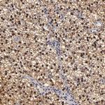 ZNF133 Antibody in Immunohistochemistry (IHC)