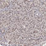 ZNF133 Antibody in Immunohistochemistry (IHC)