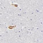 Fetuin A Antibody in Immunohistochemistry (IHC)