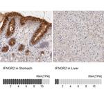 IFNGR2 Antibody in Immunohistochemistry (IHC)