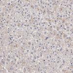 IFNGR2 Antibody in Immunohistochemistry (IHC)