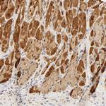 Carbonic Anhydrase II Antibody in Immunohistochemistry (IHC)