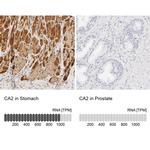 Carbonic Anhydrase II Antibody