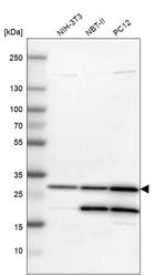 Carbonic Anhydrase II Antibody in Western Blot (WB)