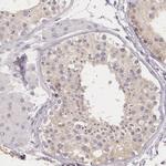 G2E3 Antibody in Immunohistochemistry (IHC)