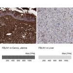 Fibulin 1 Antibody in Immunohistochemistry (IHC)