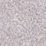 Fibulin 1 Antibody in Immunohistochemistry (IHC)