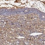 Fibulin 1 Antibody in Immunohistochemistry (IHC)