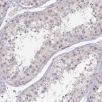 PNP Antibody in Immunohistochemistry (IHC)