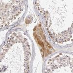 SH2D4A Antibody in Immunohistochemistry (IHC)