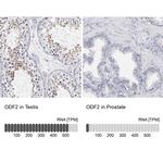 ODF2 Antibody