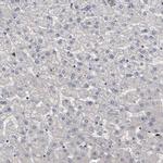 ATRX Antibody in Immunohistochemistry (IHC)