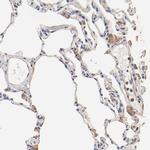 TAGLN2 Antibody in Immunohistochemistry (IHC)