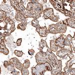 TAGLN2 Antibody in Immunohistochemistry (IHC)