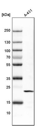 TAGLN2 Antibody in Western Blot (WB)