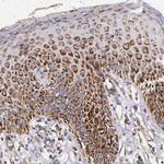 IDH3G Antibody in Immunohistochemistry (IHC)