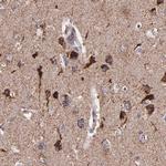 IDH3G Antibody in Immunohistochemistry (IHC)