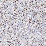 TCF2 Antibody in Immunohistochemistry (IHC)