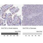 SULT1B1 Antibody in Immunohistochemistry (IHC)