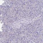 SULT1B1 Antibody in Immunohistochemistry (IHC)