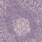 HYAL1 Antibody in Immunohistochemistry (IHC)