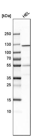 GART Antibody in Western Blot (WB)