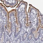 MGAM Antibody in Immunohistochemistry (IHC)