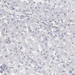 MGAM Antibody in Immunohistochemistry (IHC)