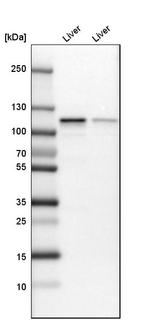 GLDC Antibody in Western Blot (WB)