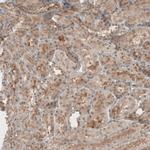 KIAA0020 Antibody in Immunohistochemistry (IHC)