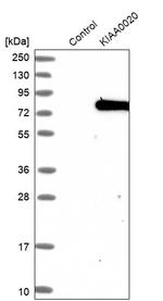 KIAA0020 Antibody in Western Blot (WB)