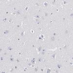 TRIM Antibody in Immunohistochemistry (IHC)