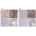 CARS Antibody in Immunohistochemistry (IHC)