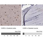 CARS Antibody