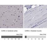 CARS Antibody in Immunohistochemistry (IHC)