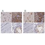 CARS Antibody in Immunohistochemistry (IHC)