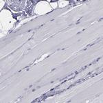 CARS Antibody in Immunohistochemistry (IHC)