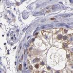 CARS Antibody in Immunohistochemistry (IHC)