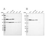 CARS Antibody in Western Blot (WB)