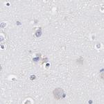 LAX1 Antibody in Immunohistochemistry (IHC)