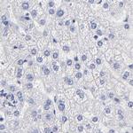 LAX1 Antibody in Immunohistochemistry (IHC)