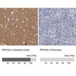 RPH3A Antibody in Immunohistochemistry (IHC)