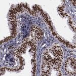 ERH Antibody in Immunohistochemistry (IHC)