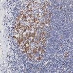 NCAPH Antibody in Immunohistochemistry (IHC)