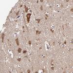 JM4 Antibody in Immunohistochemistry (IHC)