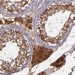 JM4 Antibody in Immunohistochemistry (IHC)