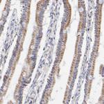 SSBP1 Antibody in Immunohistochemistry (IHC)