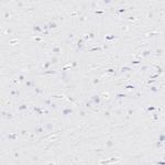 S100A12 Antibody in Immunohistochemistry (IHC)